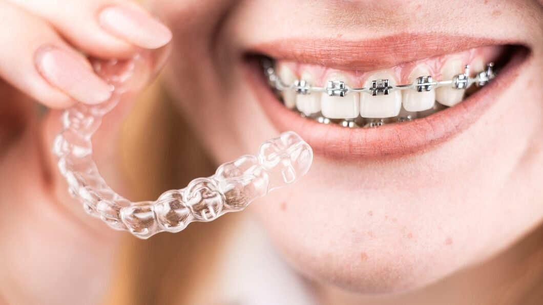 Aparat dentar Cluj-Napoca – tratamente ortodontice ProDent