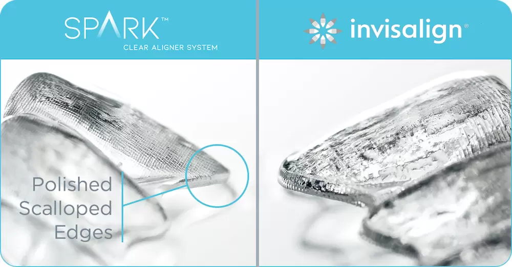 spark vs invisalign aparat ortodontic cu gutiere cluj