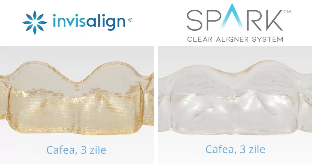 spark vs invisalign material diferenta aparat ortodontic cu gutiere invizibile prodent