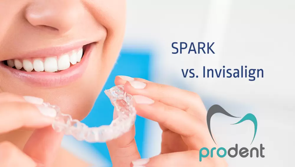 spark vs invisalign