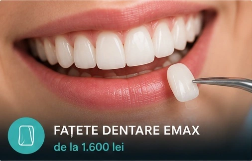 Fațete dentare Emax la ProDent Cluj